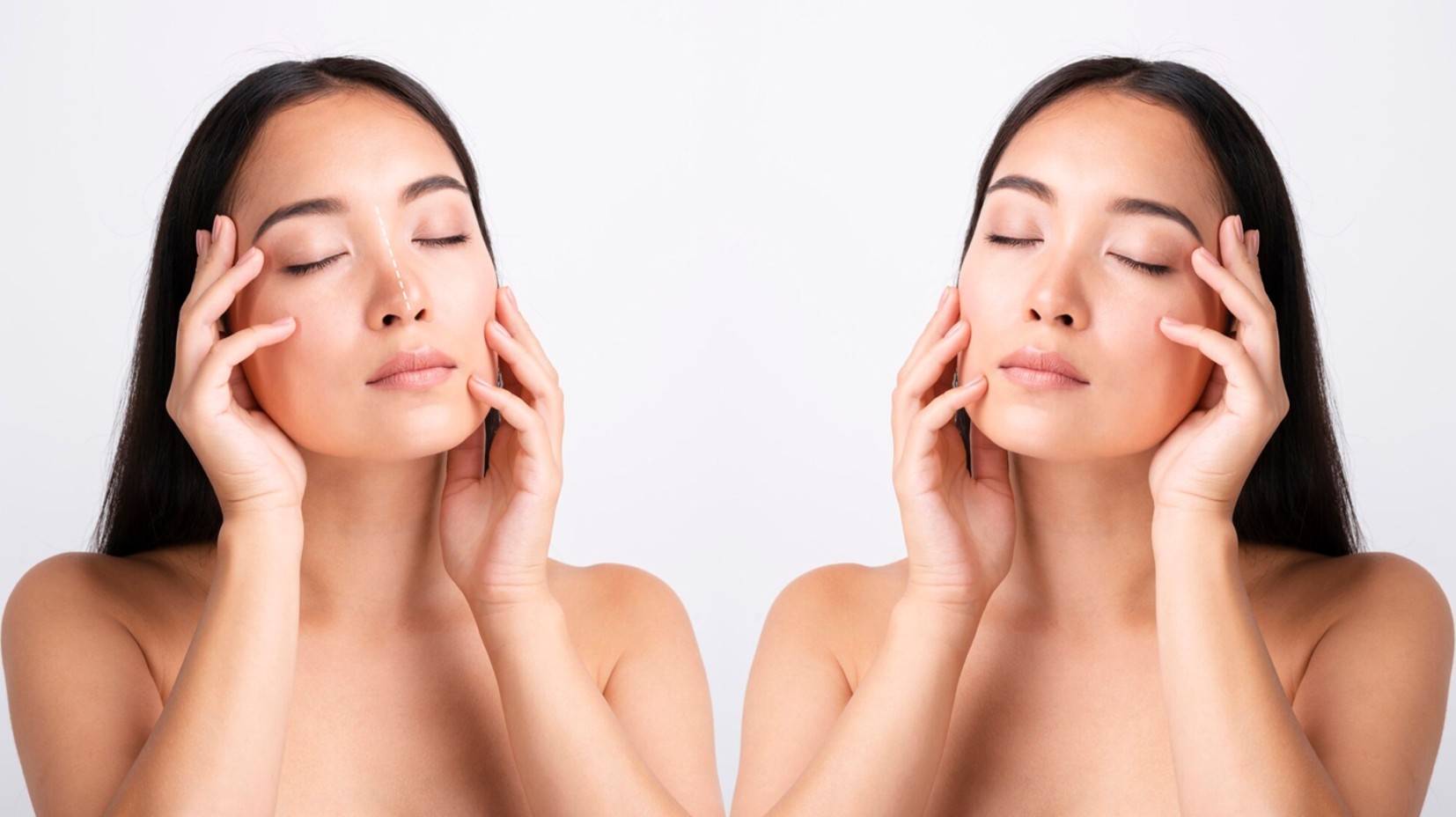 Rhinoplasty in Bangalore: Complete Travel and Surgery Planning Guide for India and International Patients